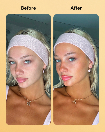BA