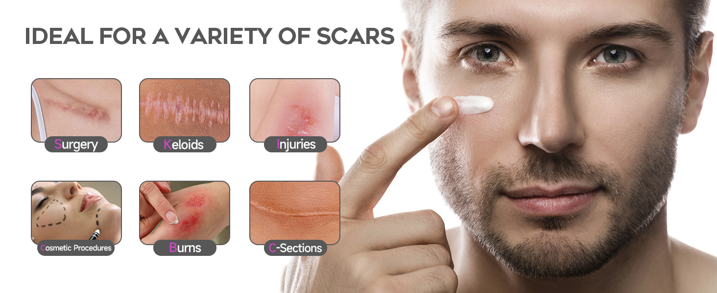 best scar treatment