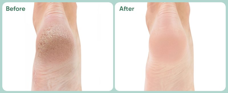 Before &amp;amp;amp;amp; After