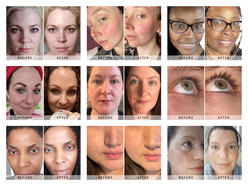 Eclat Anti-wrinkle Cream