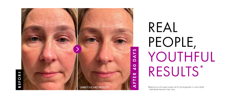 Eclat Anti-Wrinkle Cream