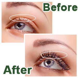 black castor oil
