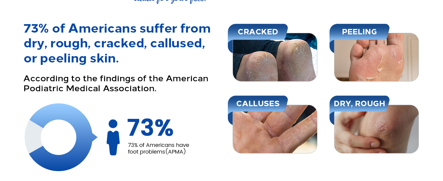For CRACKED PEELING CALLUSES DRY, ROUGH