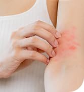 #1 Dermatologist Recommended Topical Anti-Itch Brand