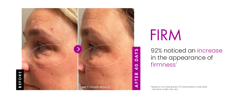 Eclat Anti-Wrinkle Cream