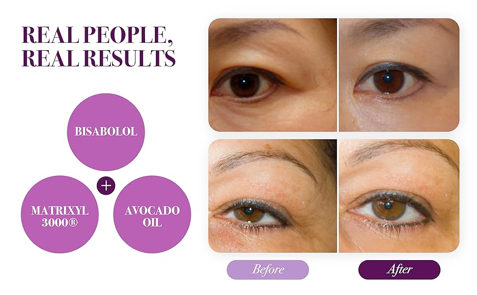 Dr Louie Eye Cream Anti Aging Cleanical Wrinkles Puffiness Dark Circles