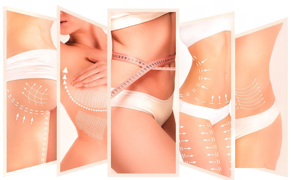 Cellulite Cream
