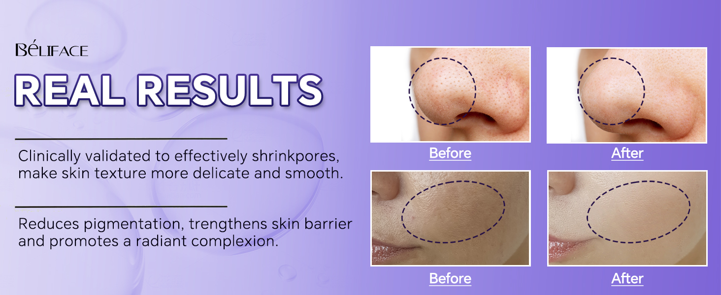hydrating serum