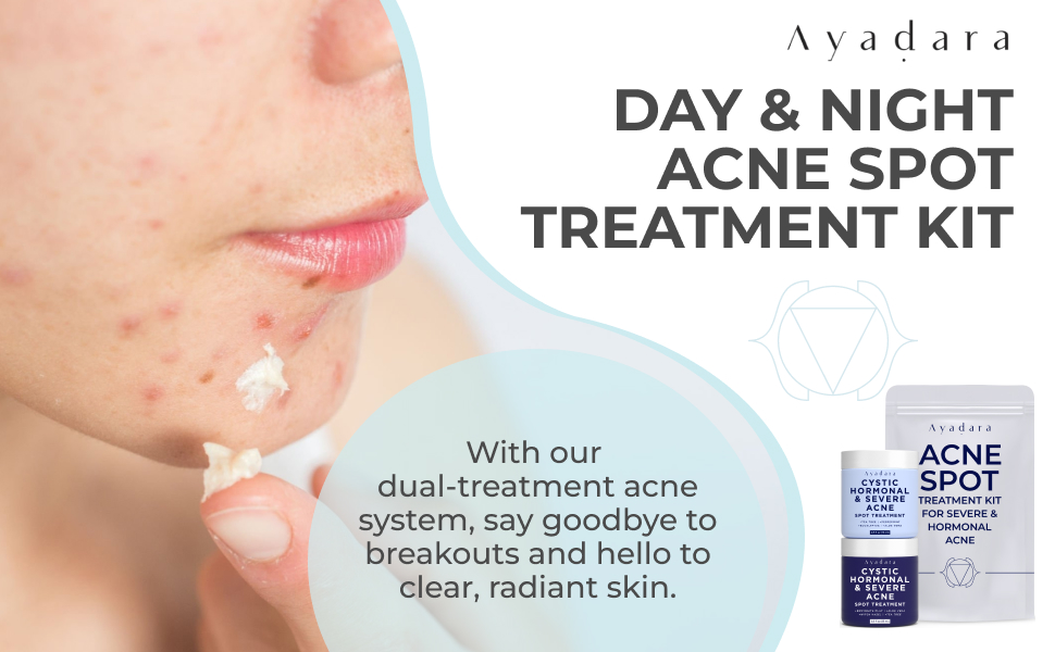 cystic acne treatment 