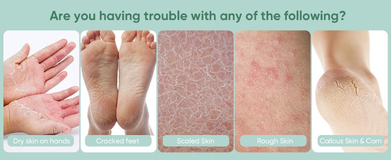 Are you having trouble with any of the following?