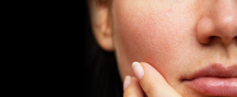 Dermatoligist recommended