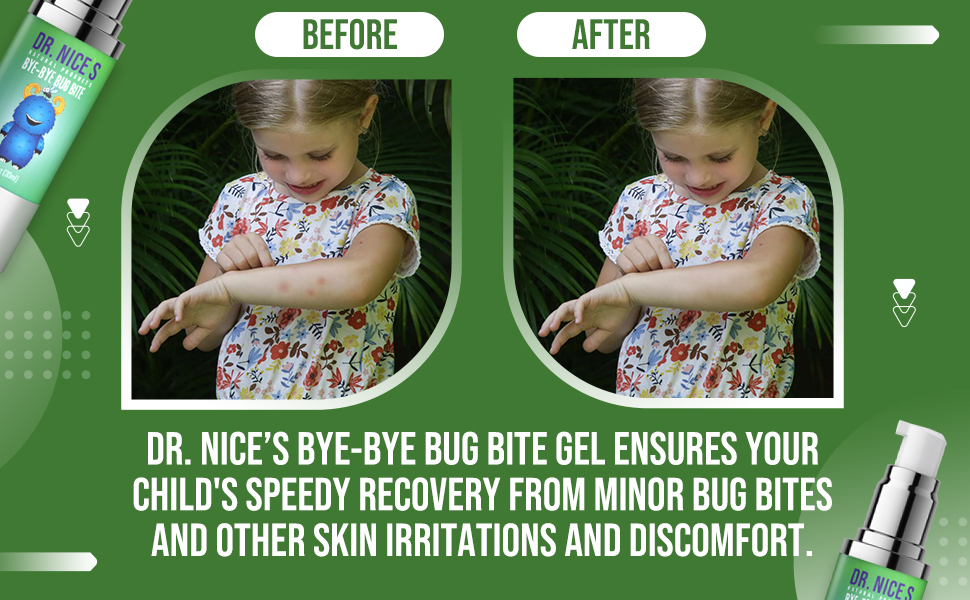 Bye Bug Bite