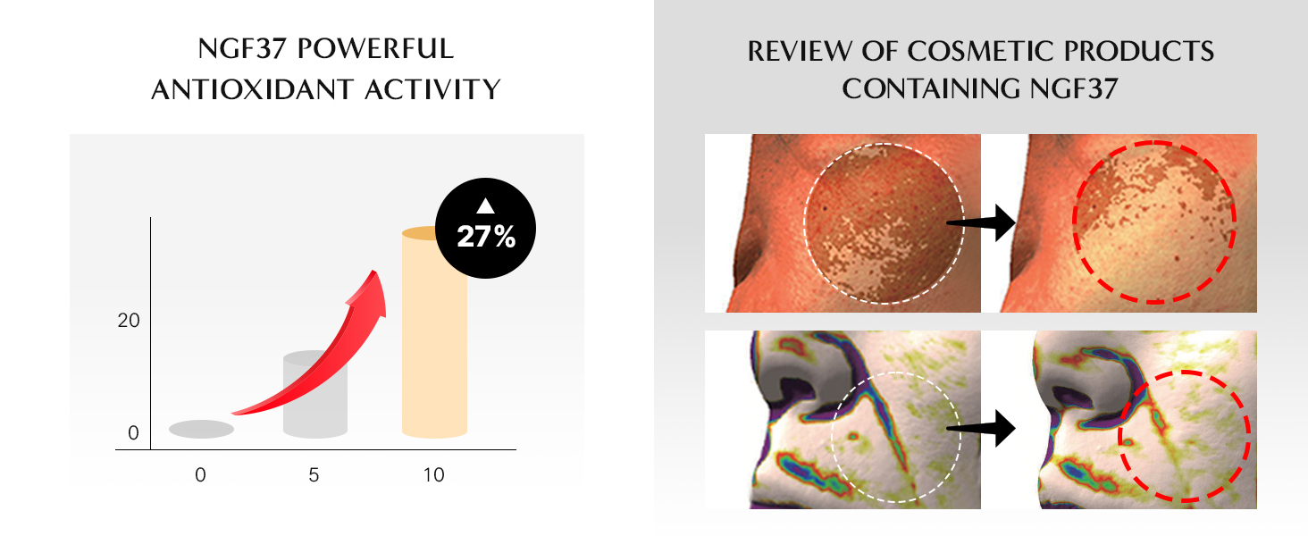 NGF37 antioxidant boost, cosmetic review, and growth factor chart with skin benefits korean skincare