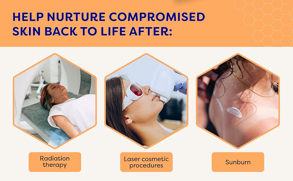 laser skin chemo beecure calendula post oncology patients lotion cancer women organic moisturizer