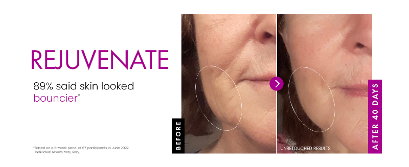 Eclat Anti-Wrinkle Cream