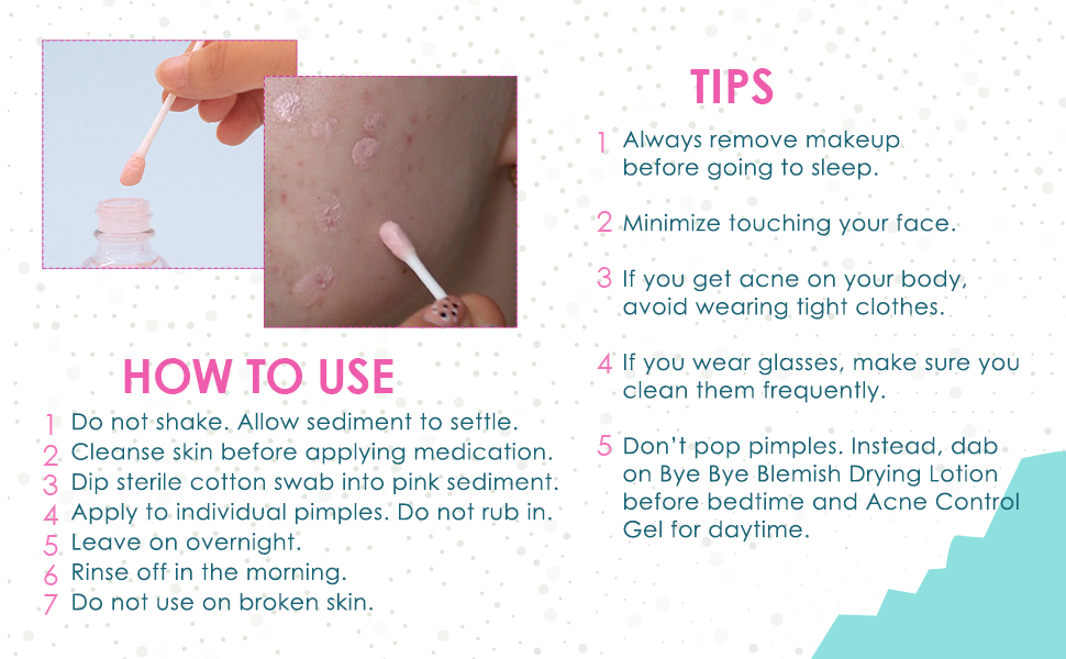 Bye Bye Blemish Acne Drying Lotion