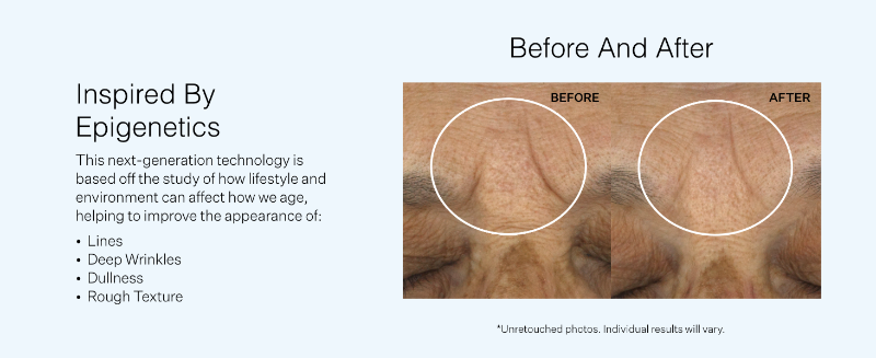 Wrinkle recode serum