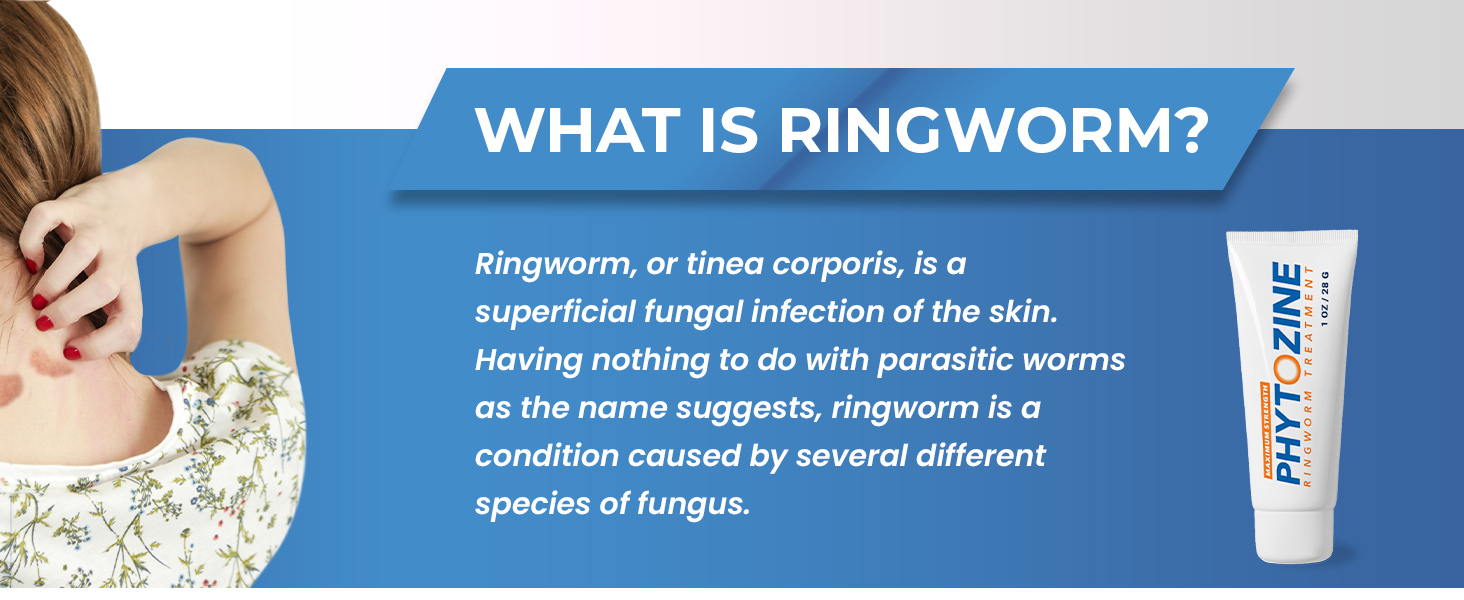 Ringworm Treatment