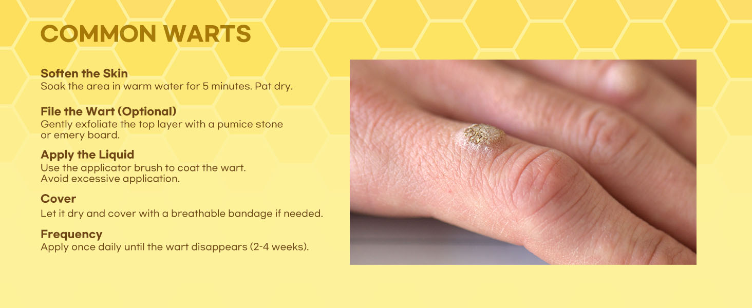 bee venom