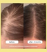 hg before and after