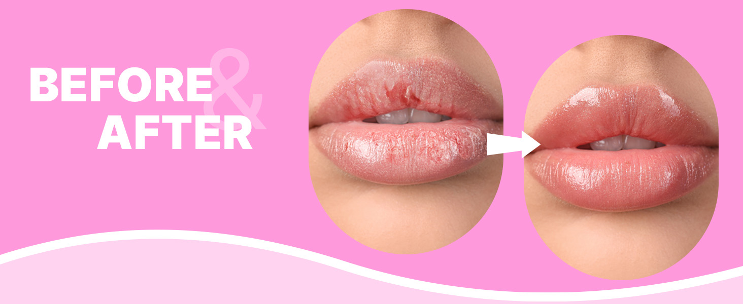 lip sleep mask set