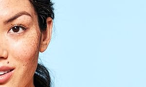Skin is smooth, luminous 