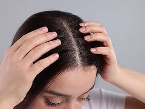 Scalp