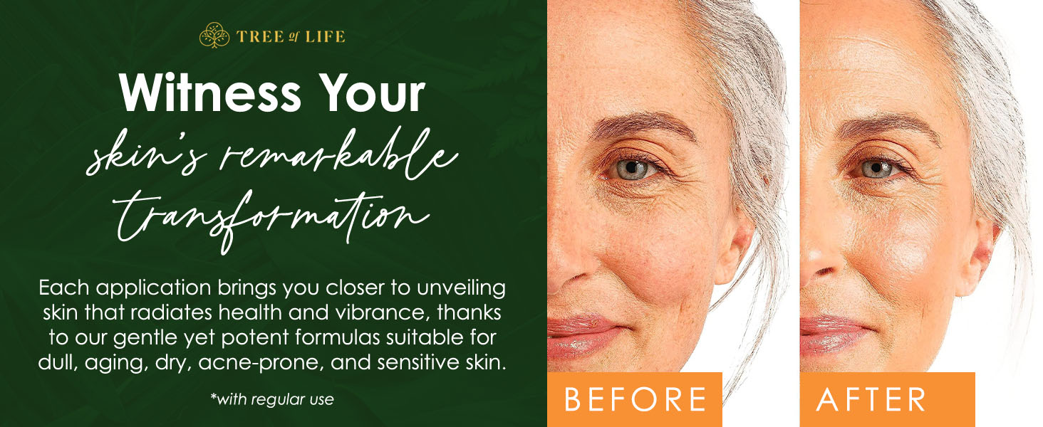 Before and after of a middle-aged woman, showing visible improvements from using Tree of Life serums