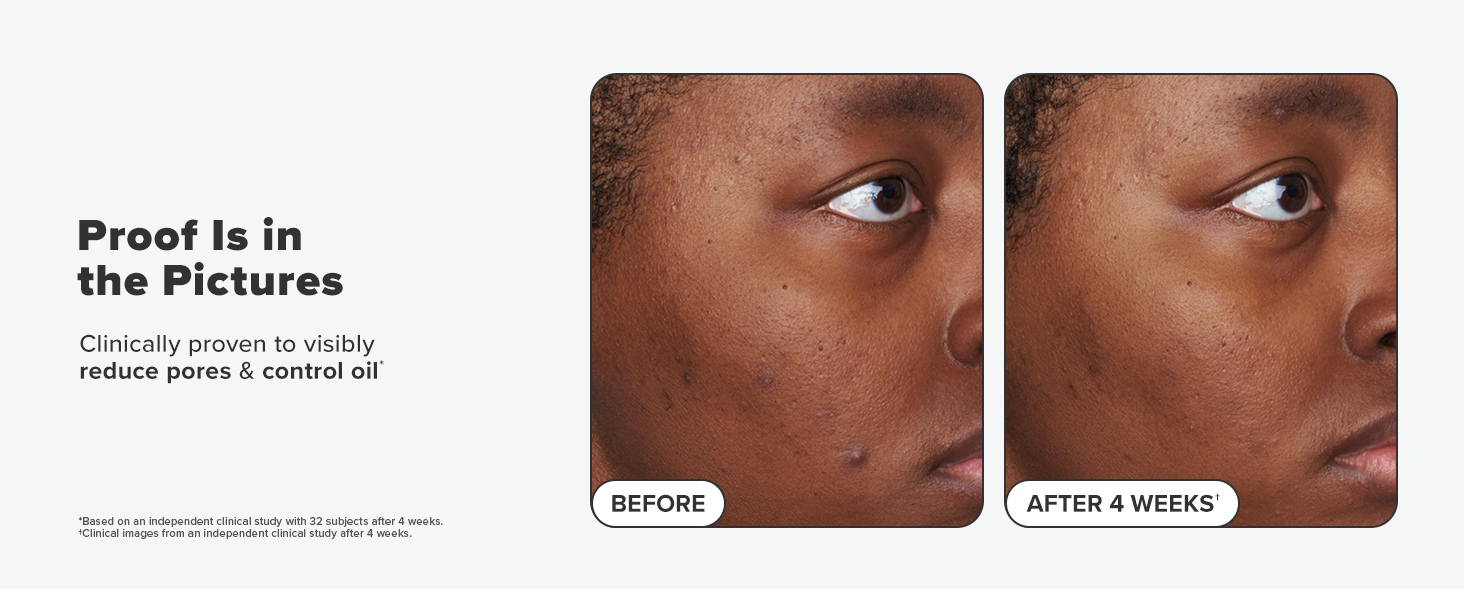 2% BHA Liquid Pads