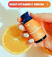 Korean skincare model holding the Seoul Ceuticals Korean Vitamin C Serum