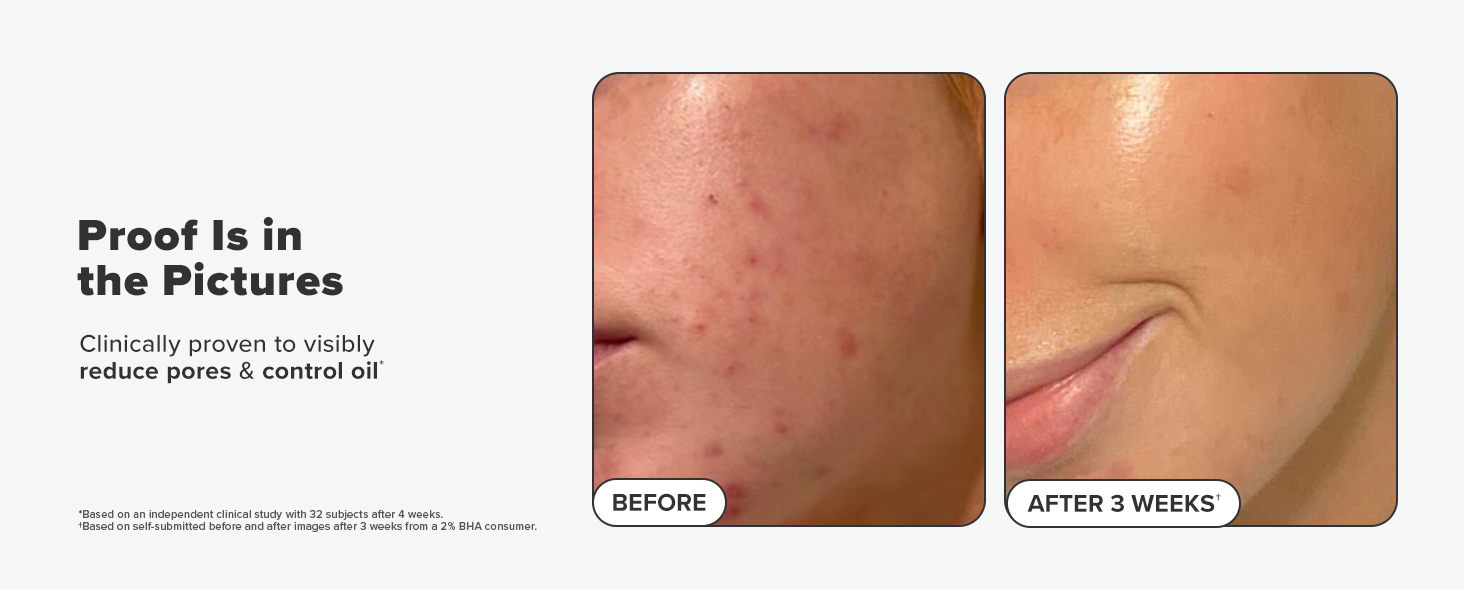 2% BHA Liquid Pads