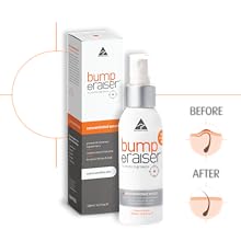 Bump Eraiser Ingrown Hair Serum