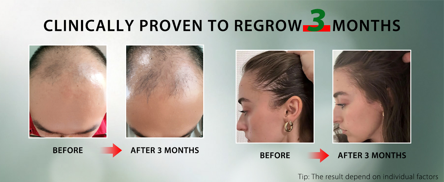 hair growth products