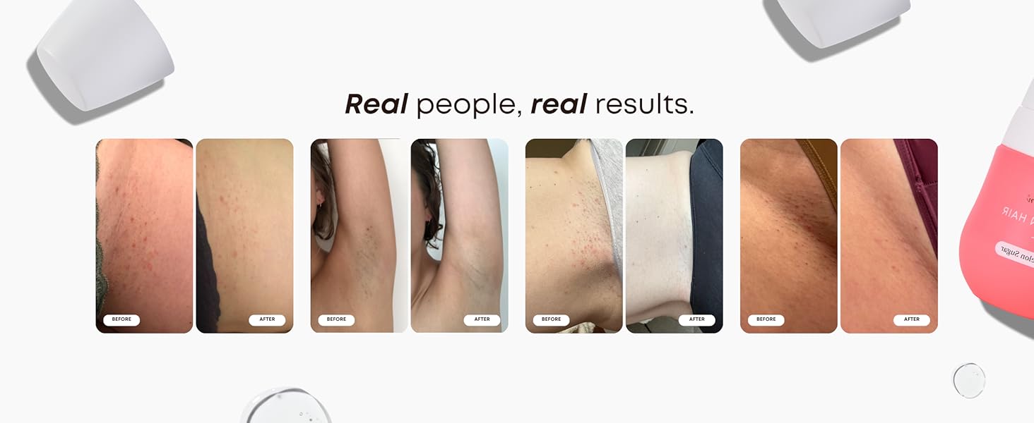 Before + After Results
