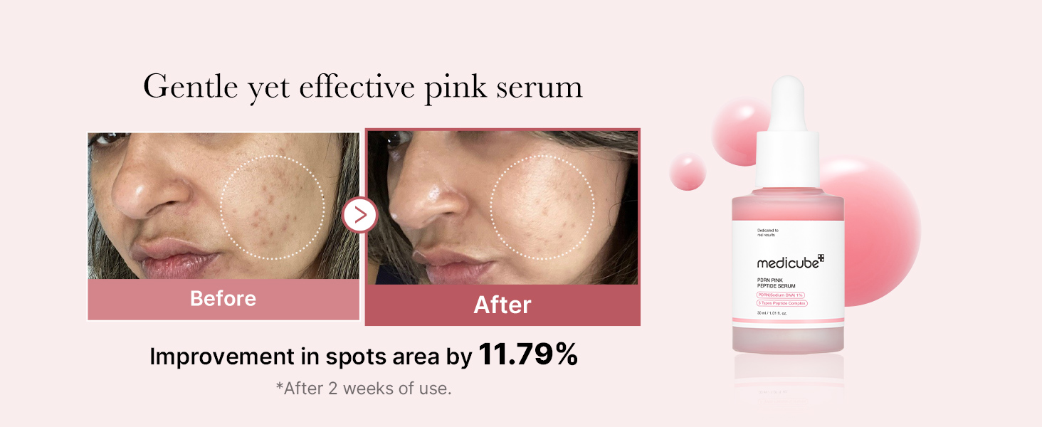 pdrn, glow serum, pink glow serum, salmon pdrn, dark spots, fine lines, salmon dna