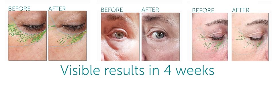 eye/lash cream before and after results and scans
