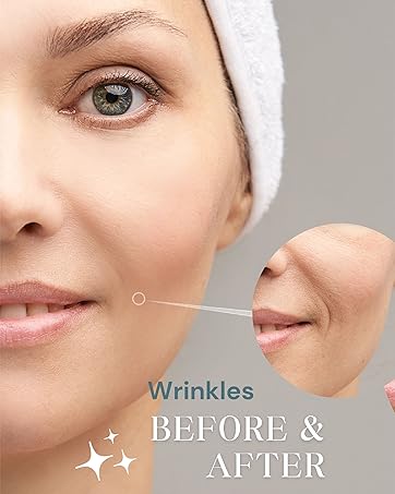 Stem Skin