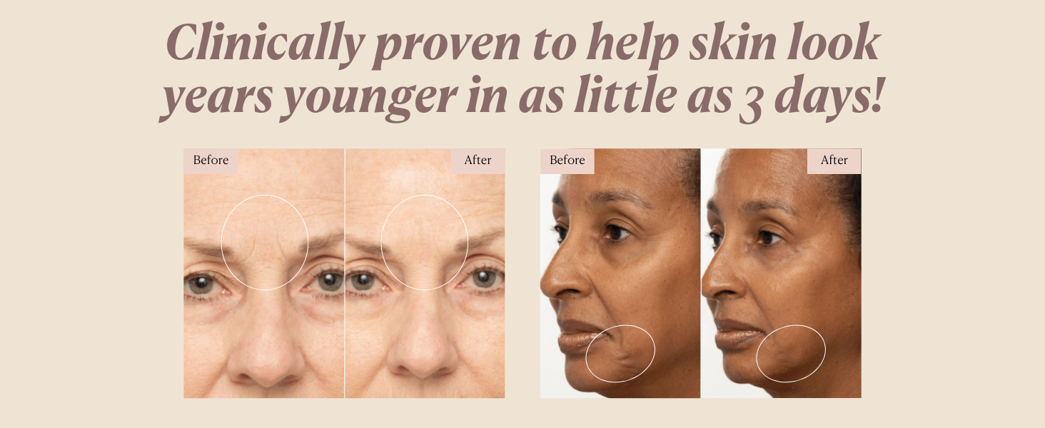 4D. Lift-Tox Face Cream