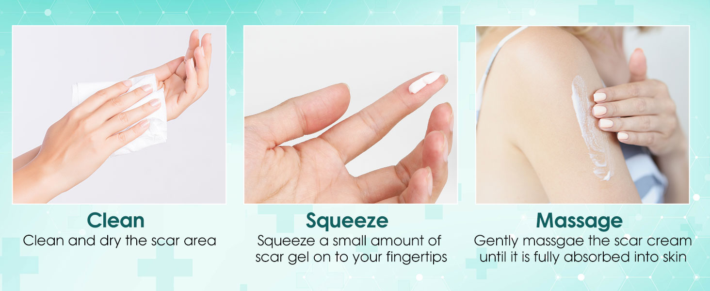 scar cream