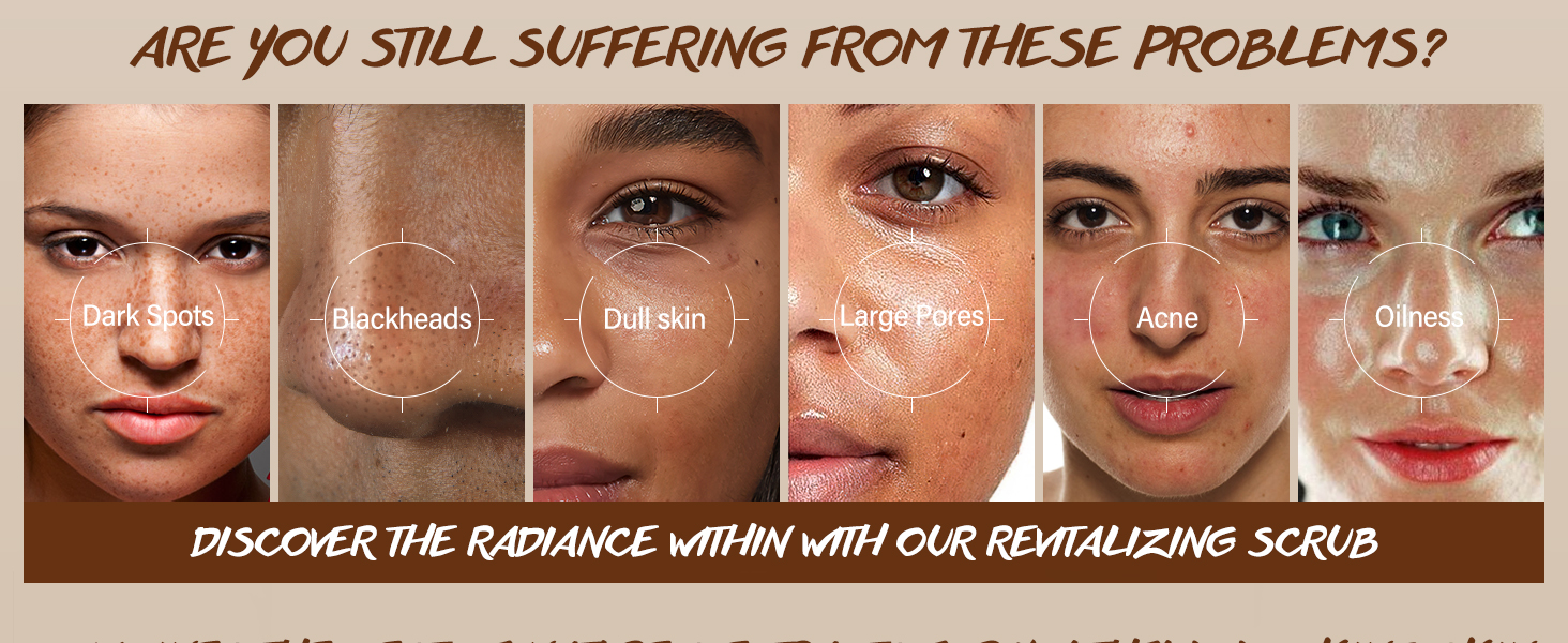 MULTIPLE FACIAL SKIN PROBLEMS
