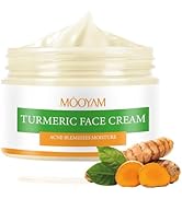 Turmeric Face Cream for Spots,Acne Cream for Face,Tumeric Moisturizer for Face Skin Care,Pimple C...