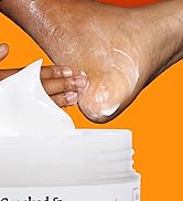 Best Cracked & Dry Heel Foot Cream