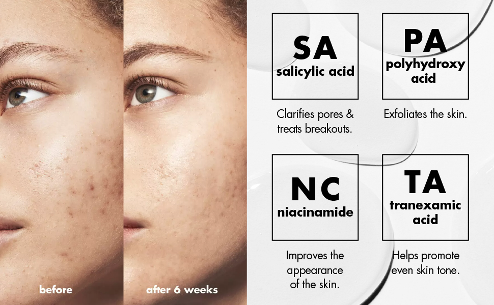 elf SKIN-BB Triple-Acid Resurfacing Serum