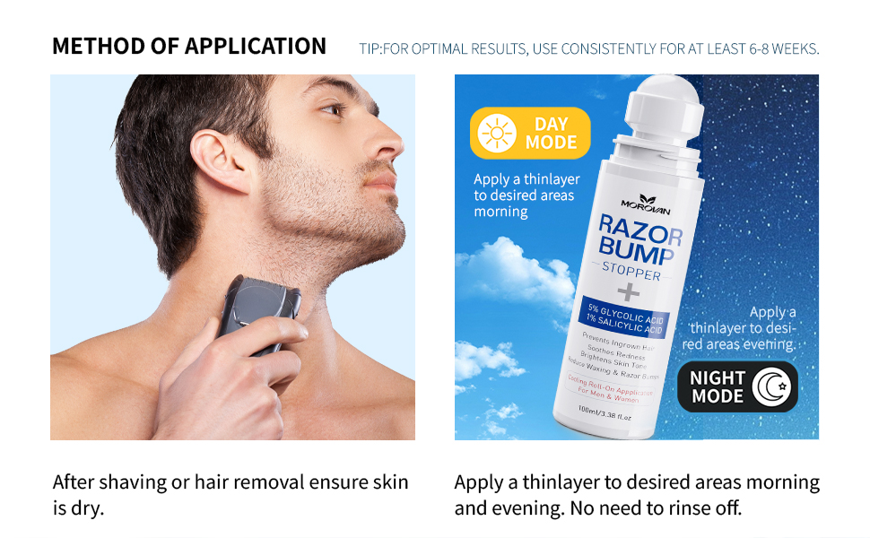 Razor Bumps Treatment