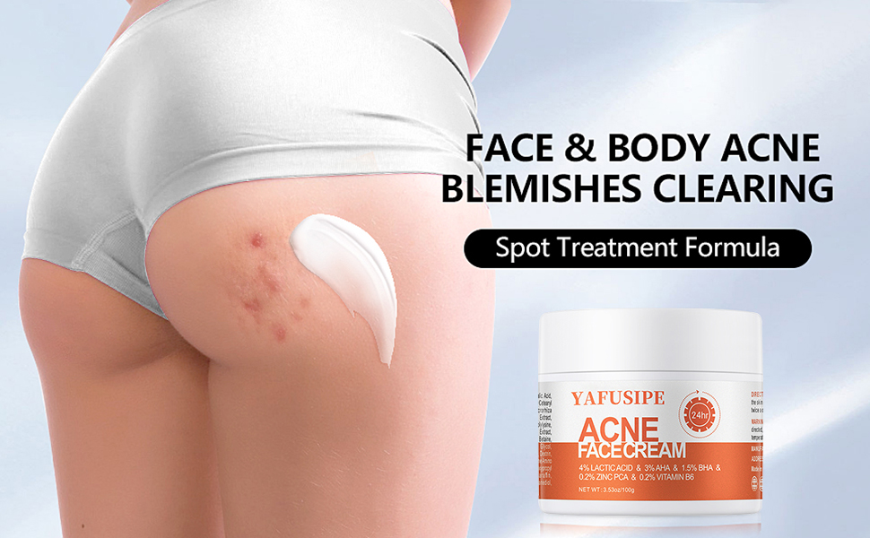 acne treatment for face acne spot treatment acne cream back acne treatment