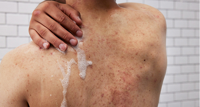 Woman patting dry her face and neck with a white washcloth