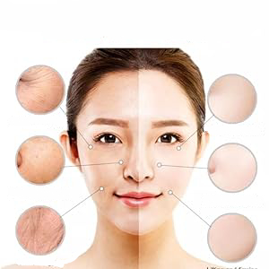 Face Moisturizer Retinol Cream