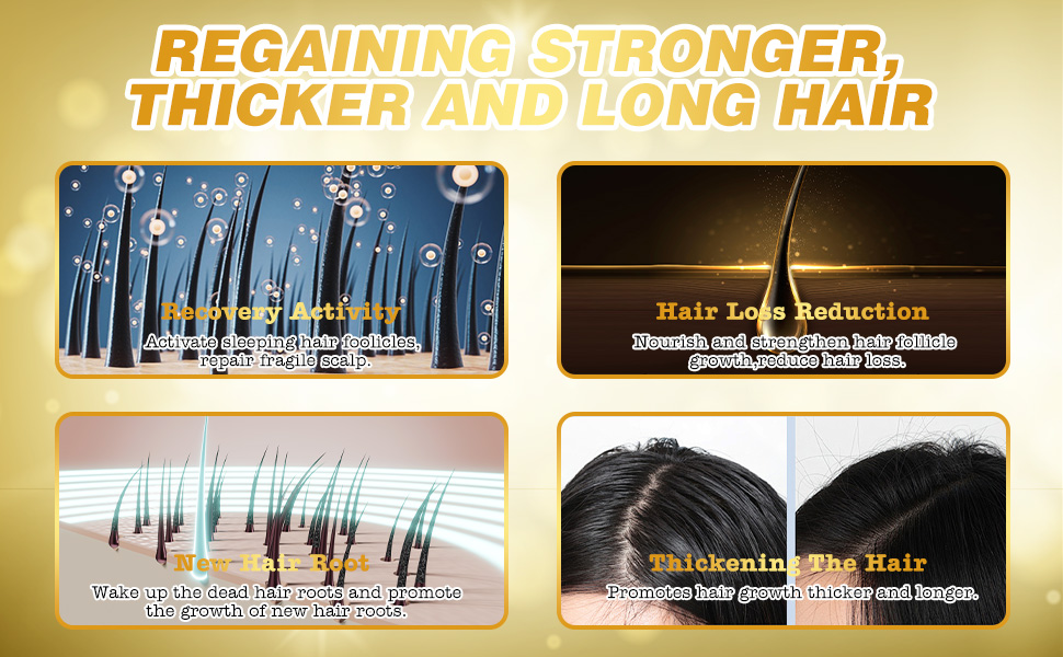 Minoxidil for Men