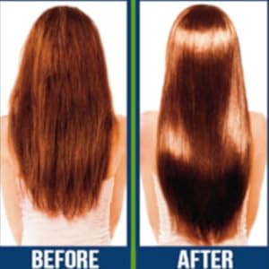 Before/After