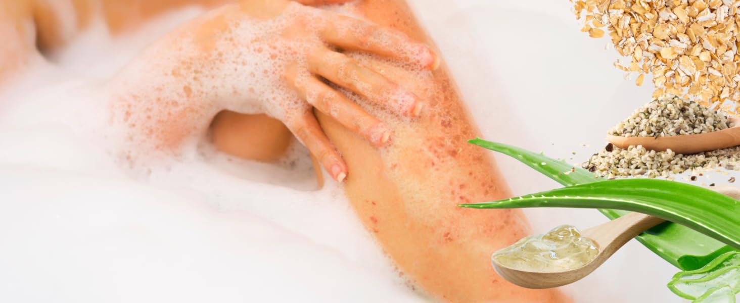 Eczema Treatment